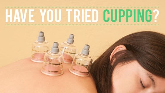 Have-You-Try-Cupping-Massage-Therapy