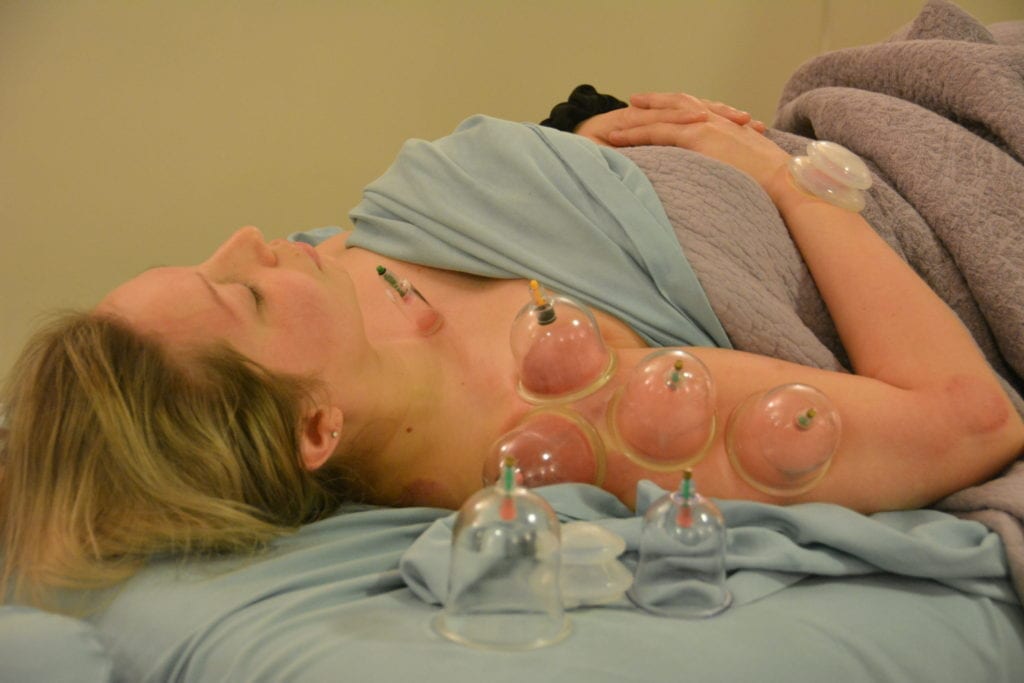 cupping massage workshop in Olympia